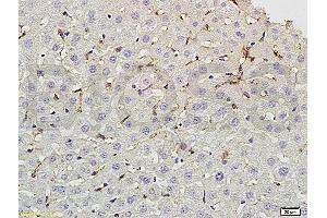 Formalin-fixed and paraffin embedded rat liver tissue labeled with Rabbit Anti-phospho-CD32B(Tyr292) Polyclonal Antibody (ABIN761411) at 1:200 followed by conjugation to the secondary antibody and DAB staining.