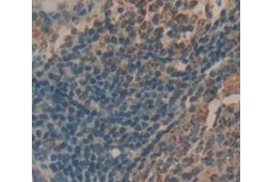 IHC-P analysis of Human Tissue, with DAB staining. (IL-21 antibody  (AA 23-155))