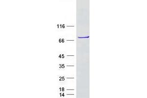 Western Blotting (WB) image for DEAD (Asp-Glu-Ala-Asp) Box Polypeptide 55 (DDX55) protein (Myc-DYKDDDDK Tag) (ABIN2719289)