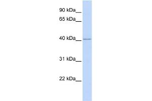 WB Suggested Anti-RING1 Antibody Titration:  0. (RING1 antibody  (Middle Region))