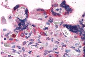 Human Placenta: Formalin-Fixed, Paraffin-Embedded (FFPE) (BAG3 antibody  (AA 563-575))