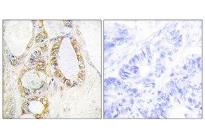 Immunohistochemistry (IHC) image for anti-Mucin 13, Cell Surface Associated (MUC13) (C-Term) antibody (ABIN1849970) (MUC13 antibody  (C-Term))