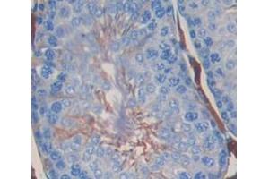 Used in DAB staining on fromalin fixed paraffin- embedded Kidney tissue (Dickkopf-Like 1 (DKKL1) (AA 21-230) antibody)