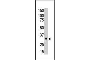 The MAGEA6 polyclonal antibody  is used in Western blot to detect MAGEA6 in A-549 cell lysate. (MAGEA6 antibody  (C-Term))