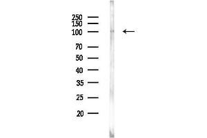 anti-Ubiquitin Specific Peptidase 13 (Isopeptidase T-3) (USP13) (C-Term) antibody