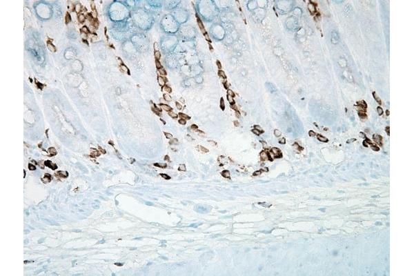 Nitrotyrosine antibody  (FITC)