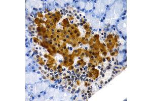 Immunohistochemistry of paraffin-embedded rat pancreas using MT2A antibody (ABIN1873764) at dilution of 1:200 (40x lens). (MT2A antibody)