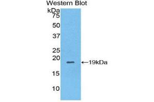 Western Blotting (WB) image for anti-Collagen, Type VIII, alpha 1 (COL8A1) (AA 590-744) antibody (ABIN3201694) (COL8A1 antibody  (AA 590-744))