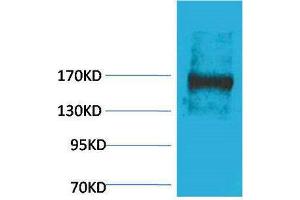 Western Blotting (WB) image for anti-Ectopic P-Granules Autophagy Protein 5 Homolog (EPG5) antibody (ABIN3181524) (EPG5 antibody)