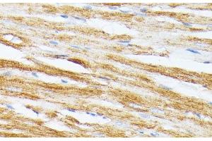 Immunohistochemistry of paraffin-embedded Rat heart using TPM2 Polyclonal Antibody at dilution of 1:100 (40x lens). (TPM2 antibody)