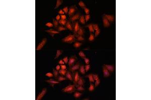 Immunofluorescence analysis of U-2 OS cells using ST antibody (ABIN6129464, ABIN6148550, ABIN6148551 and ABIN6222848) at dilution of 1:100. (STAM2 antibody  (AA 376-525))