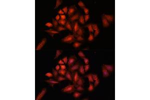 Immunofluorescence analysis of U-2 OS cells using ST antibody (ABIN6129464, ABIN6148550, ABIN6148551 and ABIN6222848) at dilution of 1:100. (STAM2 antibody  (AA 376-525))