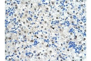 SF3B1 antibody was used for immunohistochemistry at a concentration of 4-8 ug/ml to stain Hepatocytes (arrows) in Human Liver.