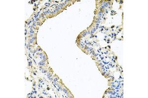 Immunohistochemistry of paraffin-embedded mouse lung using CHCHD3 antibody (ABIN5995784) at dilution of 1/100 (40x lens). (CHCHD3 antibody)