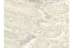 ABIN6262946 and ABIN6277777 at 1/100 staining human normal colon tissue by IHC-P. (LEF1 antibody  (Internal Region))