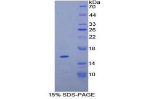 SDS-PAGE (SDS) image for Tenascin C (TNC) (AA 49-181) protein (His tag) (ABIN1080892) (TNC Protein (AA 49-181) (His tag))