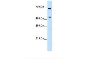 Image no. 1 for anti-Myc Proto-Oncogene protein (MYC) (N-Term) antibody (ABIN6737689) (c-MYC antibody  (N-Term))