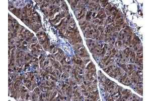 Immunohistochemistry (IHC) image for anti-phosphoglycerate Dehydrogenase (PHGDH) (N-Term) antibody (ABIN2855237)