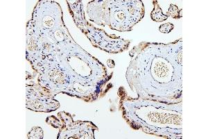 IHC analysis of SMAD2 using anti-SMAD2 antibody (ABIN6719361). (SMAD2 antibody  (AA 83-264))