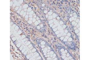 Immunohistochemistry of paraffin-embedded Human colon using ZNRF3 Polyclonal Antibody at dilution of 1:100 (40x lens).