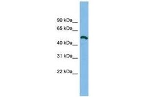Image no. 1 for anti-Zinc Finger Protein 829 (ZNF829) (AA 179-228) antibody (ABIN6744883) (ZNF829 antibody  (AA 179-228))