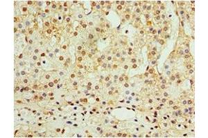 Immunohistochemistry of paraffin-embedded human adrenal gland tissue using ABIN7144558 at dilution of 1:100 (ADAP1 antibody  (AA 1-374))
