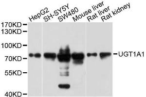 Western blot analysis of extracts of various cell lines, using UGT1A1 antibody. (UGT1A1 antibody  (AA 1-200))