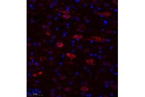 Immunofluorescence of paraffin embedded rat corpus striatum using TTC33 (ABIN7075871) at dilution of 1: 650 (300x lens) (TTC33 antibody)
