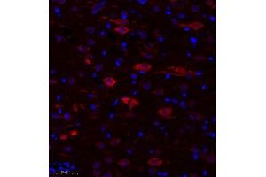 Immunofluorescence of paraffin embedded rat corpus striatum using TTC33 (ABIN7075871) at dilution of 1: 650 (300x lens) (TTC33 antibody)