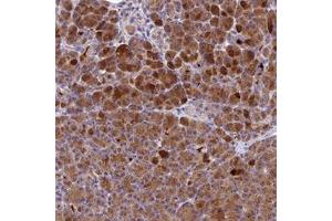 Immunohistochemical staining of human pancreas with PZP polyclonal antibody  shows strong cytoplasmic positivity in exocrine glandular cells at 1:10-1:20 dilution.