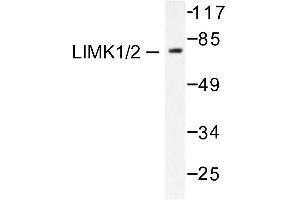 Image no. 1 for anti-LIM Domain Kinase 1 (LIMK1) antibody (ABIN265508) (LIM Domain Kinase 1 antibody)