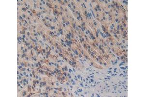 Used in DAB staining on fromalin fixed paraffin- embedded Kidney tissue (DOK7 antibody  (AA 63-320))