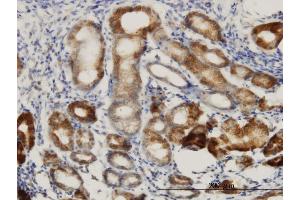 Immunostaining (ISt) image for anti-DnaJ (Hsp40) Homolog, Subfamily C, Member 10 (DNAJC10) (AA 688-793) antibody (ABIN565733)