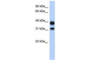Image no. 1 for anti-Chitinase, Acidic (CHIA) (N-Term) antibody (ABIN6743114) (CHIA antibody  (N-Term))