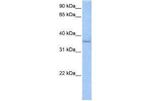 ACPT antibody used at 0. (ACPT antibody  (Middle Region))