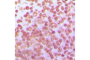 Immunohistochemical analysis of TFDP1 staining in human tonsil formalin fixed paraffin embedded tissue section. (DP1 antibody  (C-Term))