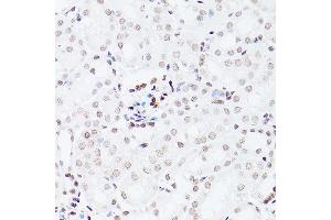 Immunohistochemistry (IHC) image for anti-NOP2/Sun Domain Family, Member 5 (NSUN5) (AA 277-466) antibody (ABIN7268955)