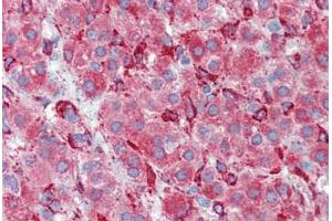 Human Adrenal (formalin-fixed, paraffin-embedded) stained with SERPINH1 antibody ABIN462363 followed by biotinylated anti-mouse IgG secondary antibody ABIN481714, alkaline phosphatase-streptavidin and chromogen. (SERPINH1 antibody)