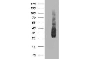 Western Blotting (WB) image for anti-ATG3 Autophagy Related 3 (ATG3) antibody (ABIN1496761) (ATG3 antibody)