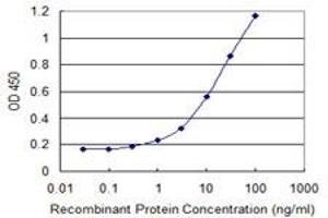 Detection limit for recombinant GST tagged HDAC8 is 0. (HDAC8 antibody  (AA 1-100))