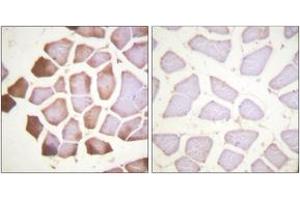 Immunohistochemistry (IHC) image for anti-Cardiac Troponin I (TNNI3) (AA 5-54) antibody (ABIN1532420)
