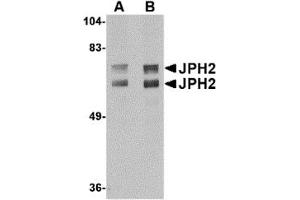 Western Blotting (WB) image for anti-Junctophilin 2 (JPH2) (C-Term) antibody (ABIN1030832)