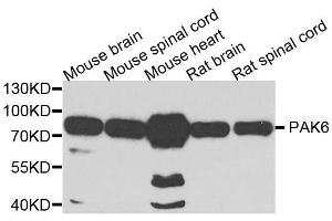 Western blot analysis of extracts of various cell lines, using PAK6 antibody. (PAK6 antibody  (AA 1-270))