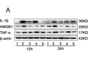 The effects of miR-339-5p and paeonol on LPS-induced RAW264. (IL-1 beta antibody  (AA 1-269))