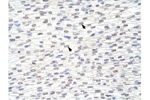 GRHL3 antibody was used for immunohistochemistry at a concentration of 4-8 ug/ml to stain Myocardial cells (arrows) in Human Heart.