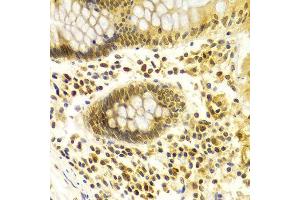 Immunohistochemistry (IHC) image for anti-Mdm2, p53 E3 Ubiquitin Protein Ligase Homolog (Mouse) (MDM2) (AA 130-230) antibody (ABIN3020951)