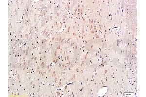 Formalin-fixed and paraffin embedded rat brain labeled with Rabbit Anti-Cytochrome C Polyclonal Antibody, Unconjugated (ABIN723590) 1:300 followed by conjugation to the secondary antibody and DAB staining