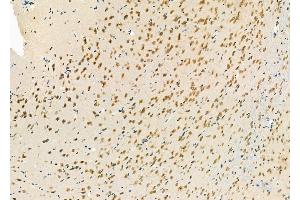 ABIN6264064 and ABIN6277250 at 1/100 staining Rat brain tissue by IHC-P. (PCBP2 antibody  (Internal Region))