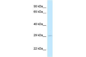 WB Suggested Anti-4933408B17Rik Antibody Titration: 1. (4933408B17Rik antibody  (C-Term))