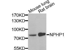 Western blot analysis of extracts of various cell lines, using NPHP1 antibody.